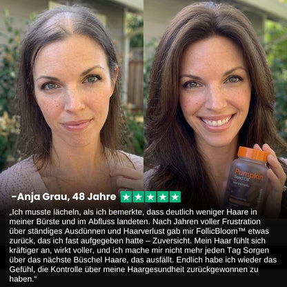 FollicBloom™ | Kürbiskernöl DHT-ausgleichende Formel