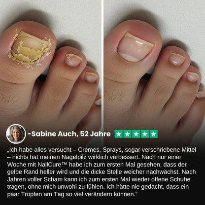 NailCure™ | Fungi Nail Triple Action Formel