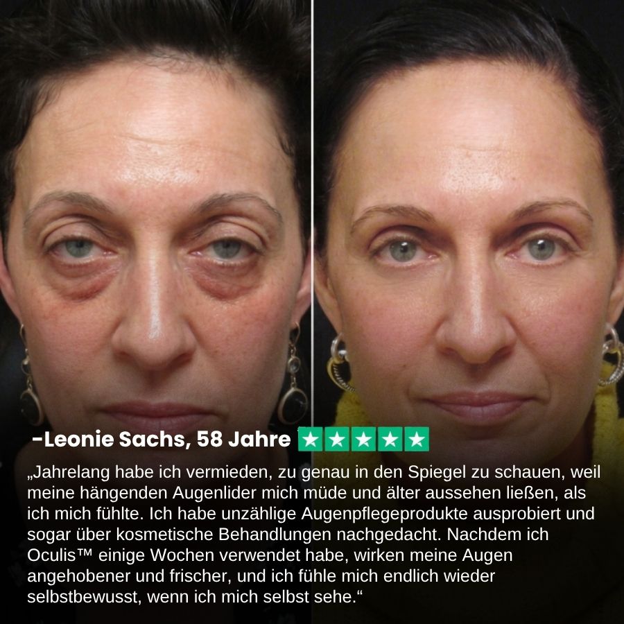Oculis™  | Stift zum Anheben der Augenlider