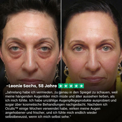 Oculis™  | Stift zum Anheben der Augenlider