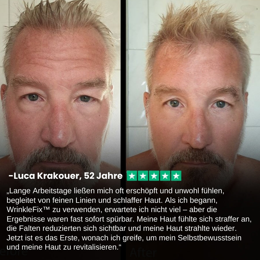 WrinkleFix™ | Nordic Tallow Wrinkle Defense Balsam für Männer