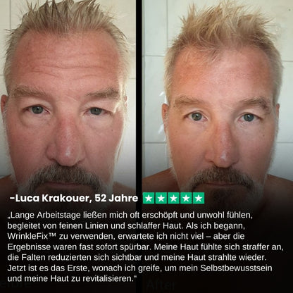 WrinkleFix™ | Nordic Tallow Wrinkle Defense Balsam für Männer