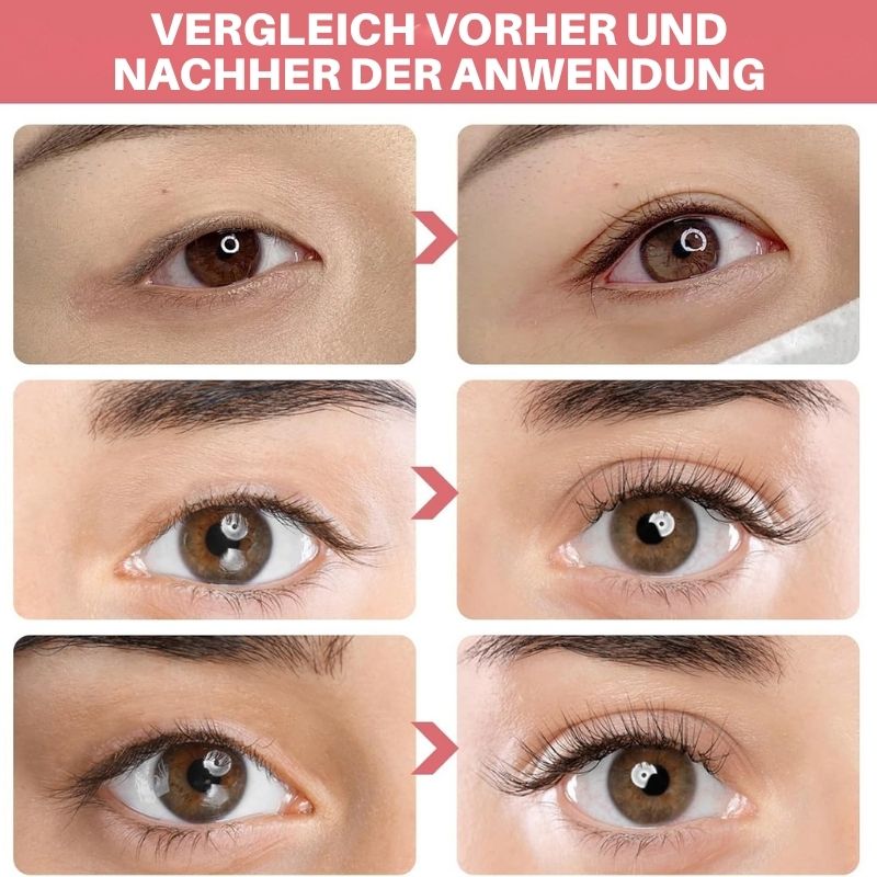 LidLifty™ | Doppelaugenlid-Formungscosmetik