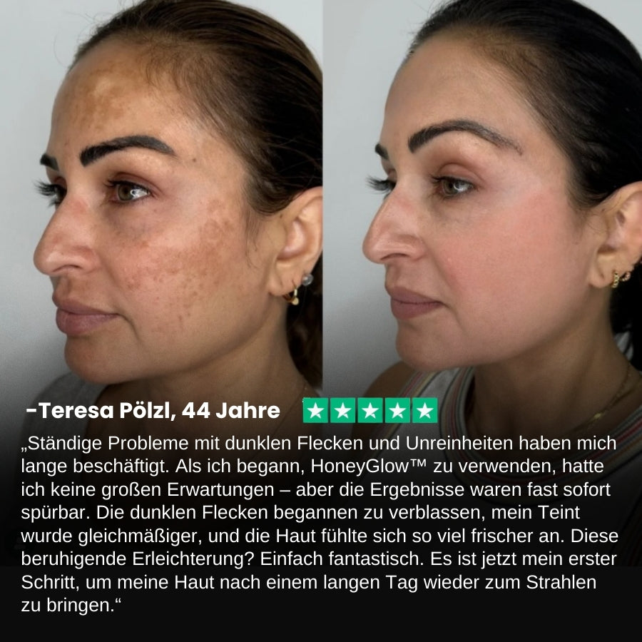 HoneyGlow™ | Kräuter-Peel-Off-Gesichtsmaske mit Honig für Flecken