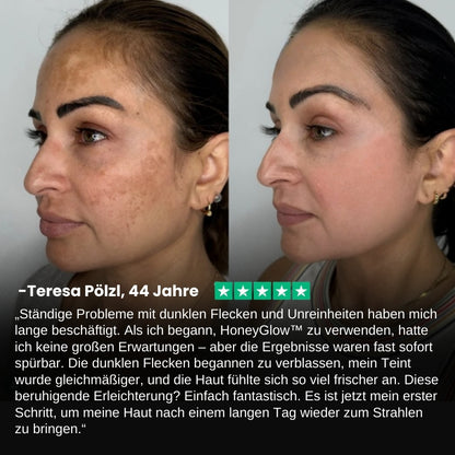HoneyGlow™ | Kräuter-Peel-Off-Gesichtsmaske mit Honig für Flecken
