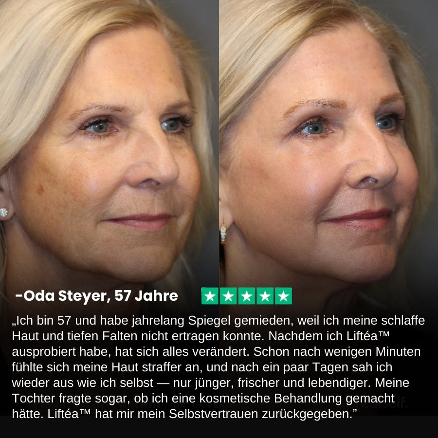 Liftéa™ | Sofort straffende Gesichtscreme