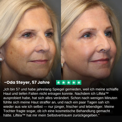 Liftéa™ | Sofort straffende Gesichtscreme