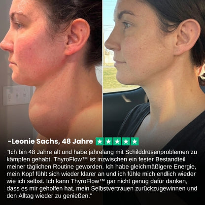ThyroFlow™ | Hashimoto-Schilddrüsenunterstützungs-Formel