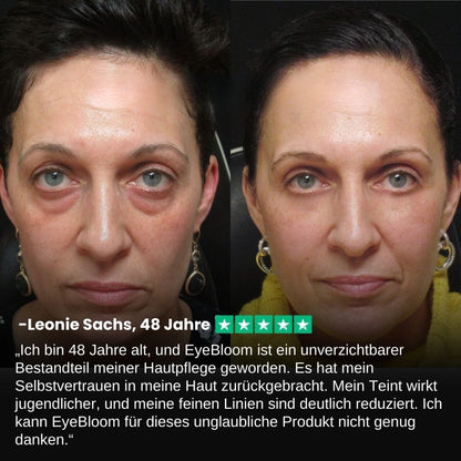 EyeBloom™ | Intense Eye Revive Creme