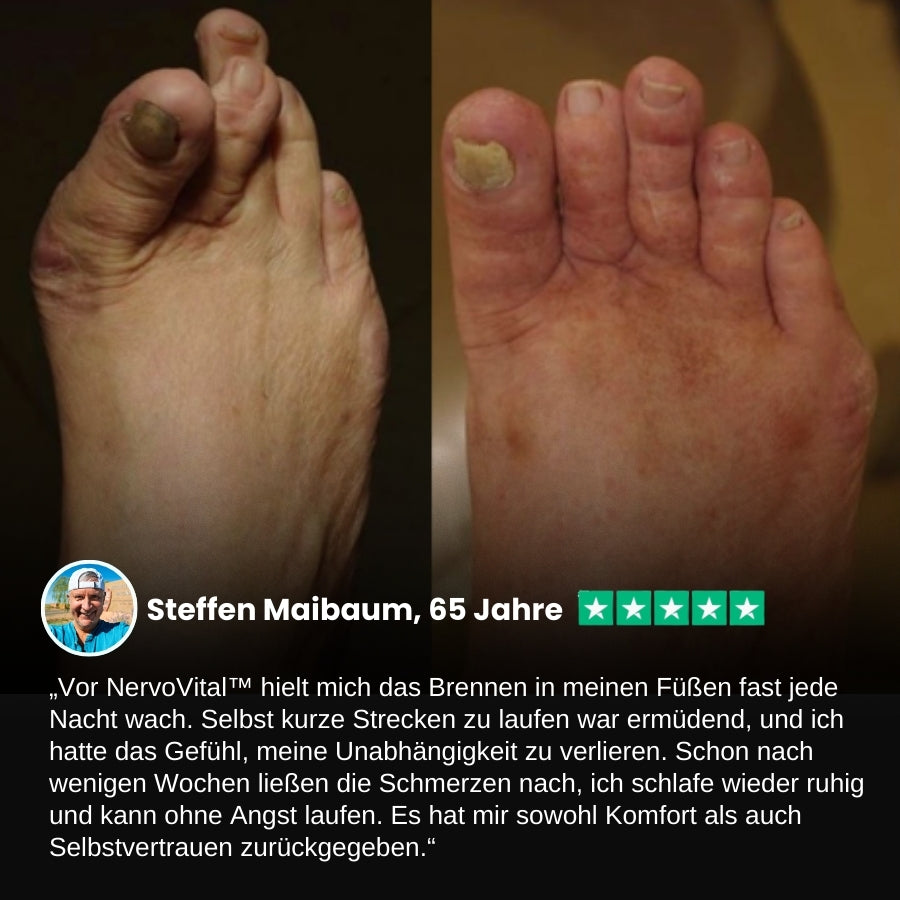 NervoVital™ | Nervenschmerz-Linderungscreme