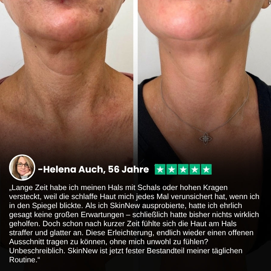SkinNew™ | Erleben Sie festere, strahlendere und jünger aussehende Haut – mit Ergebnissen schon nach 2 Wochen!