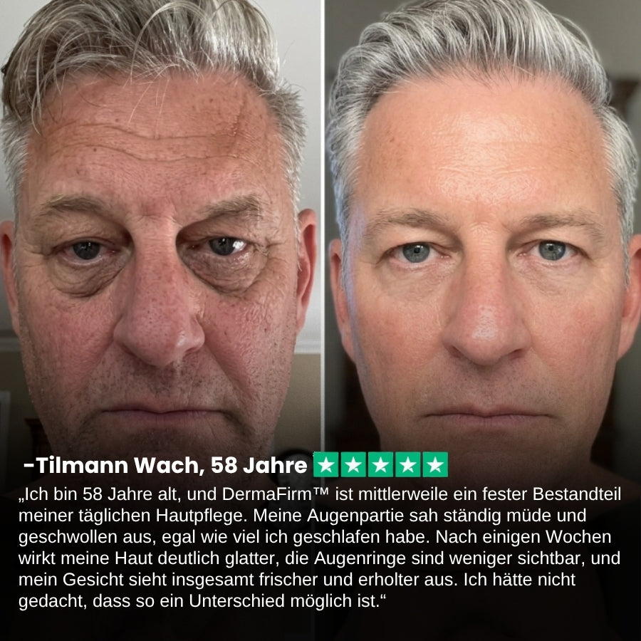 DermaFirm™ | Falten-Schutz Talg-Balsam