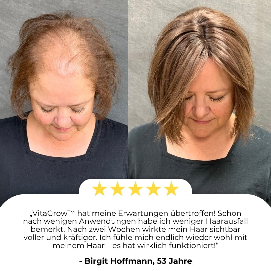 VitaGrow™  | Biotin Haarwuchs-Spray