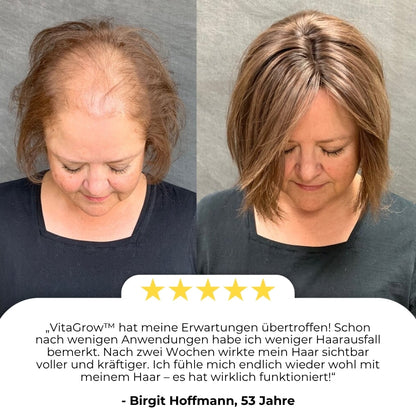 VitaGrow™  | Biotin Haarwuchs-Spray