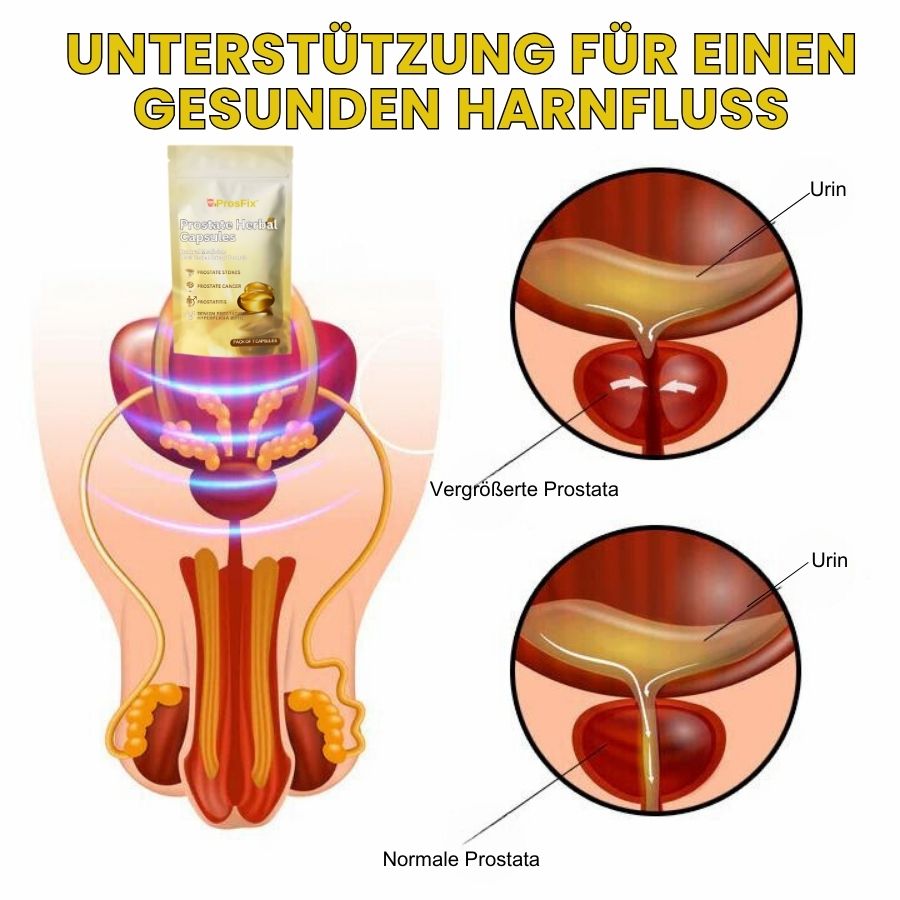 ProsFix™ | Pflanzliche Prostata-Kapsel