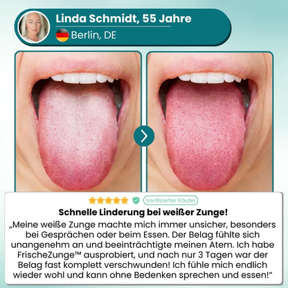 FrischeZunge™ | Frischer Atem 24/7