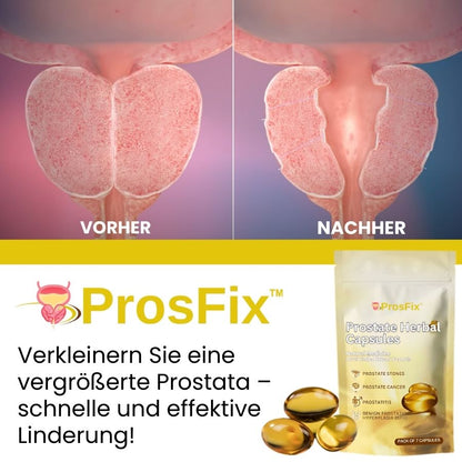 ProsFix™ | Pflanzliche Prostata-Kapsel