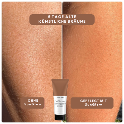 SunGlow™ | Anti-Patch Tan Lotion