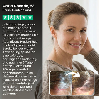 DermaCalm™ | Natürliche Linderung bei juckender Kopfhaut oder Haut