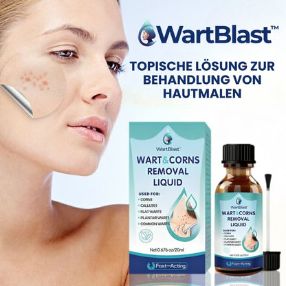 WartBlast™ | Warzen- und Hühneraugen-Entfernungsflüssigkeit
