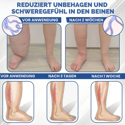 SwelEase™ | Kräutercreme zur Ödempflege
