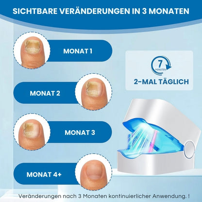 ClearNail Pro™ | Nagelpilz-Lasergerät