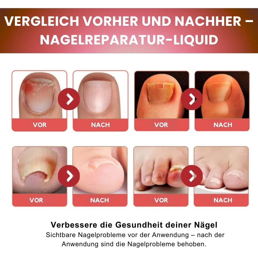 NailCure™ | Fungi Nail Triple Action Formel