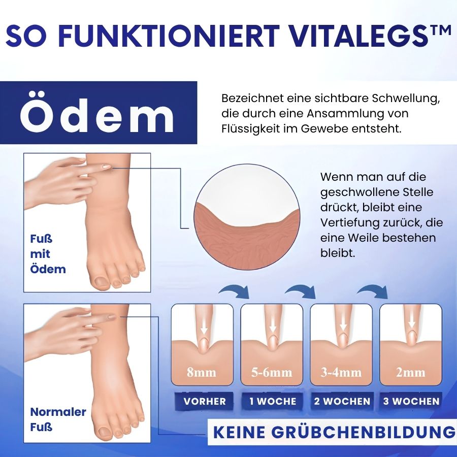 VitaLegs™ | Anti-Ödem-Creme