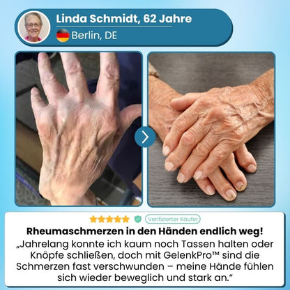 GelenkPro™ | Hyaluron-Creme gegen Gelenkschmerzen