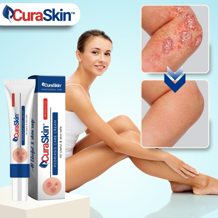 CuraSkin™ | Psoriasis- und Ekzem-Creme