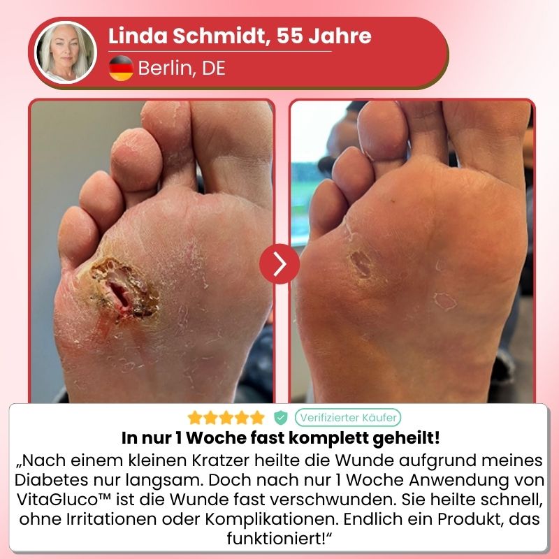VitaGluco™ | Diabetische Hautreparaturcreme
