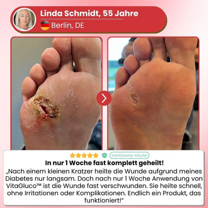 VitaGluco™ | Diabetische Hautreparaturcreme