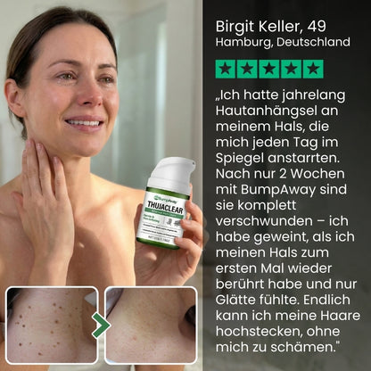 BumpAway™ | Botanische Warzen-Creme