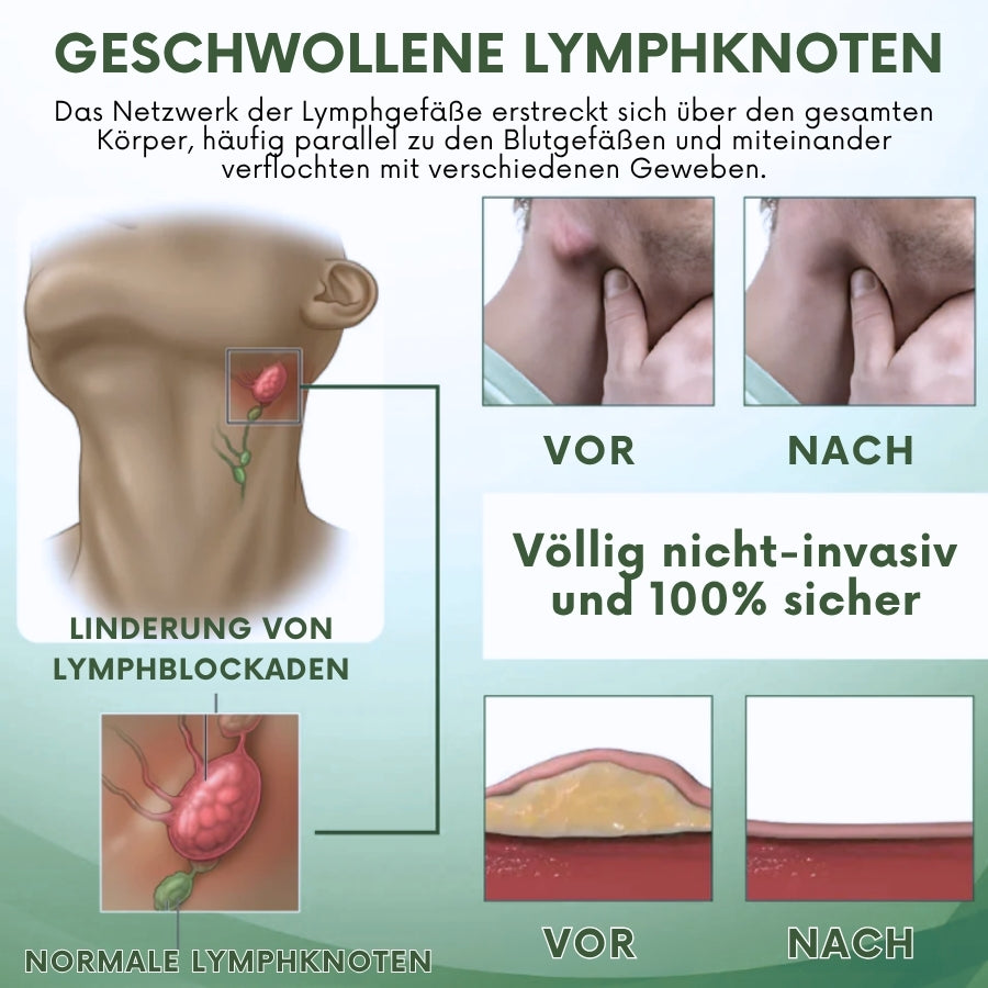 SwellPure™ | Lymphatic Detox Kräutercreme