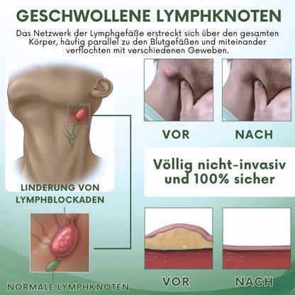 SwellPure™ | Lymphatic Detox Kräutercreme