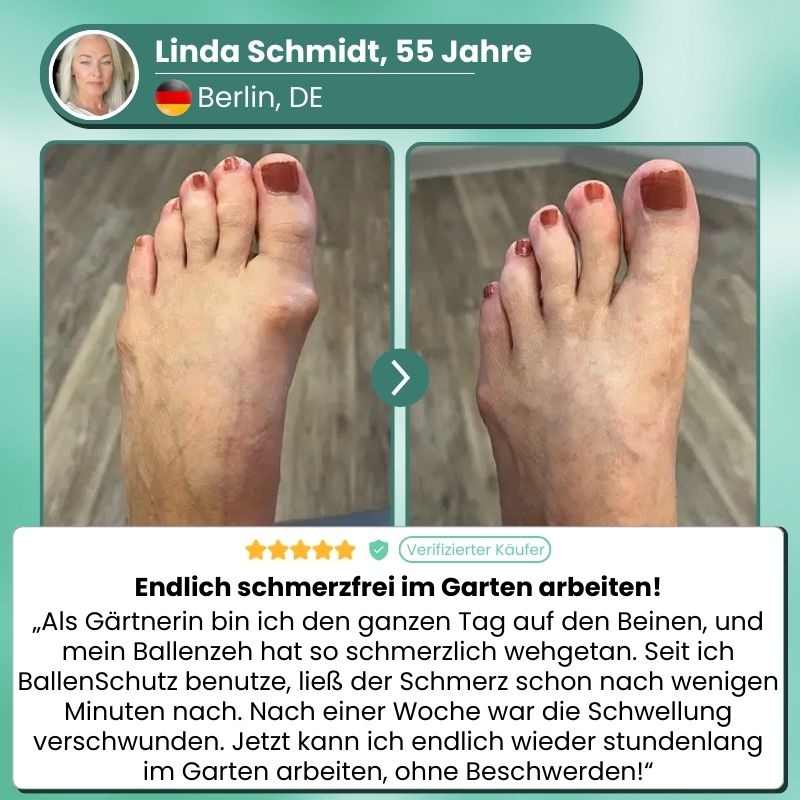 OrthoAlign™ | Sichtbare Korrektur bei Hallux Valgus bereits ab der ersten Anwendung!