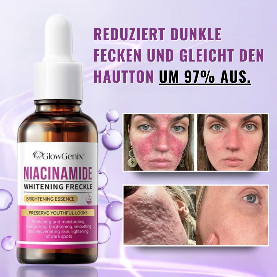 GlowGenix™ | Niacinamid Aufhellendes Sommersprossen Serum