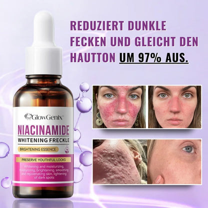 GlowGenix™ | Niacinamid Aufhellendes Sommersprossen Serum