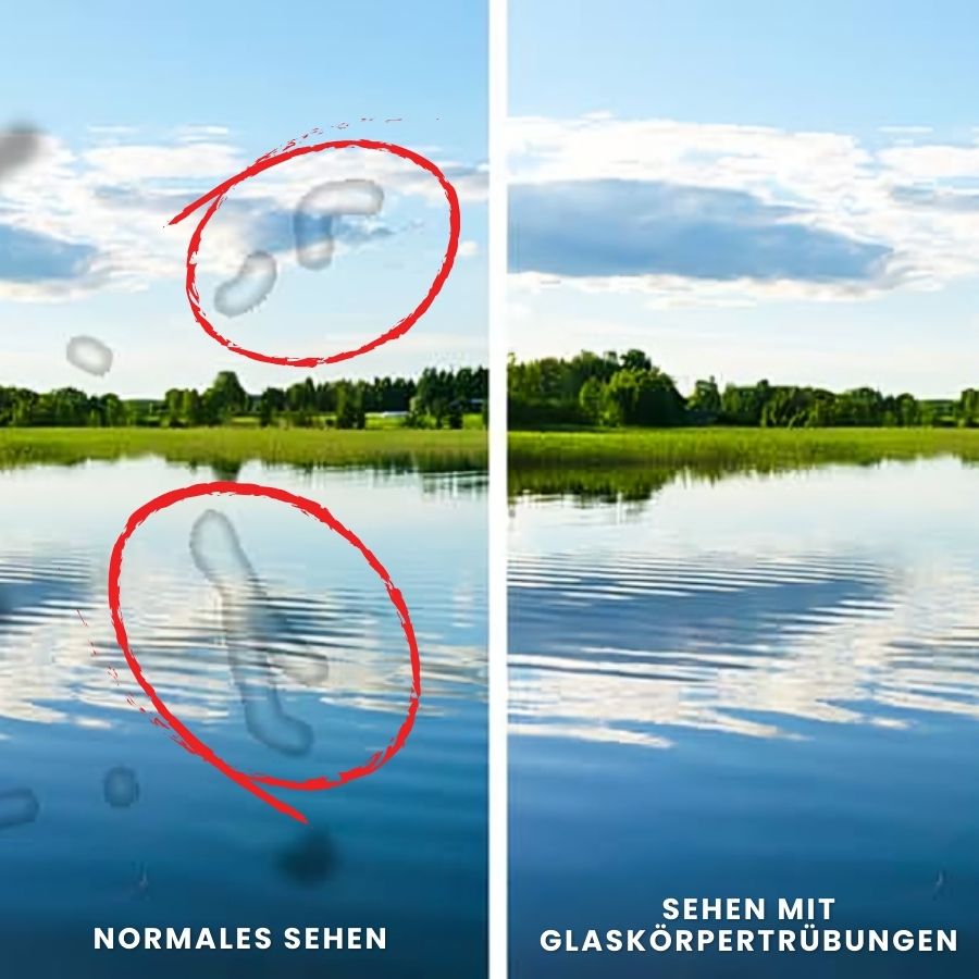 LuminEye™ | Fortschrittliche Unterstützung für Augen und Makula