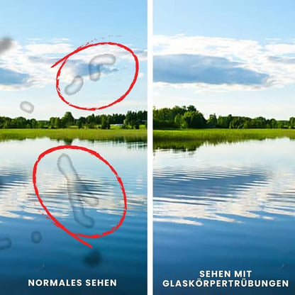 LuminEye™ | Fortschrittliche Unterstützung für Augen und Makula