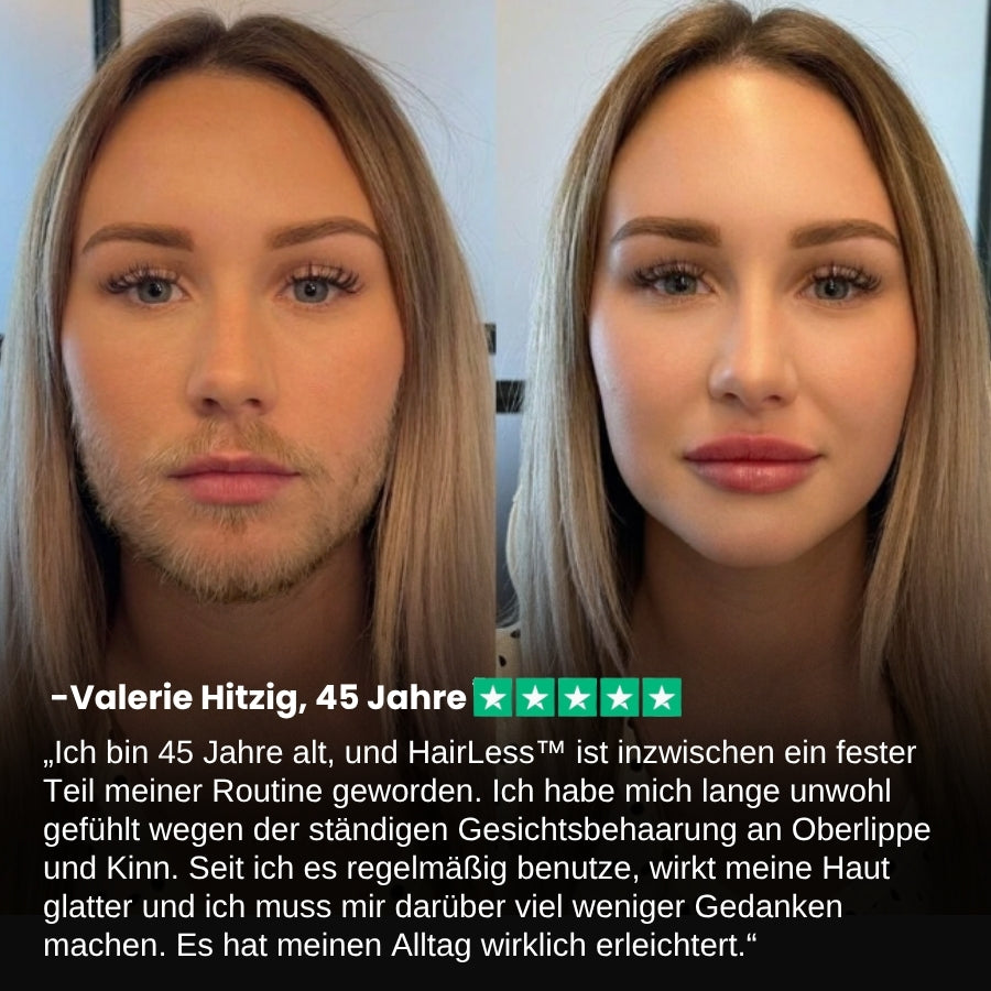 HairLess™ | Gesichts-Haarentfernungscreme