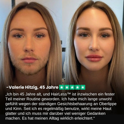 HairLess™ | Gesichts-Haarentfernungscreme