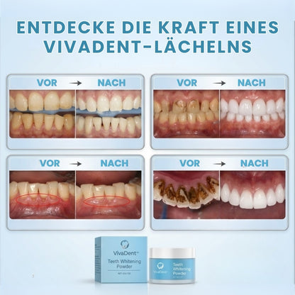 VivaDent™ | Zahnreparaturpulver