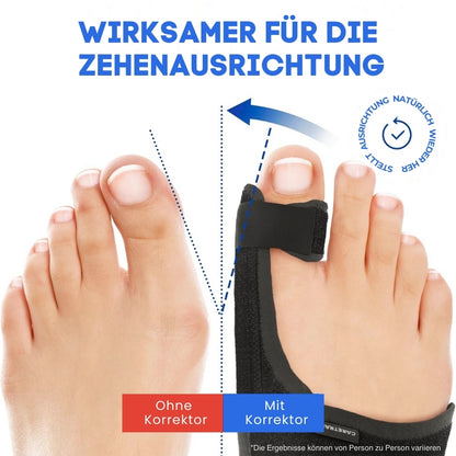FootFlexi™ | Hallux-Valgus-Entlastungsschiene