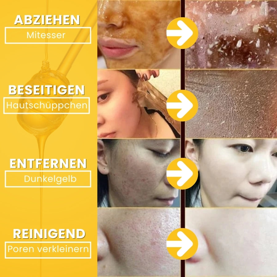 HoneyGlow™ | Kräuter-Peel-Off-Gesichtsmaske mit Honig für Flecken