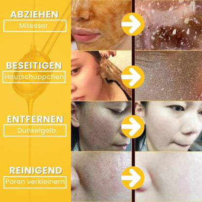 HoneyGlow™ | Kräuter-Peel-Off-Gesichtsmaske mit Honig für Flecken