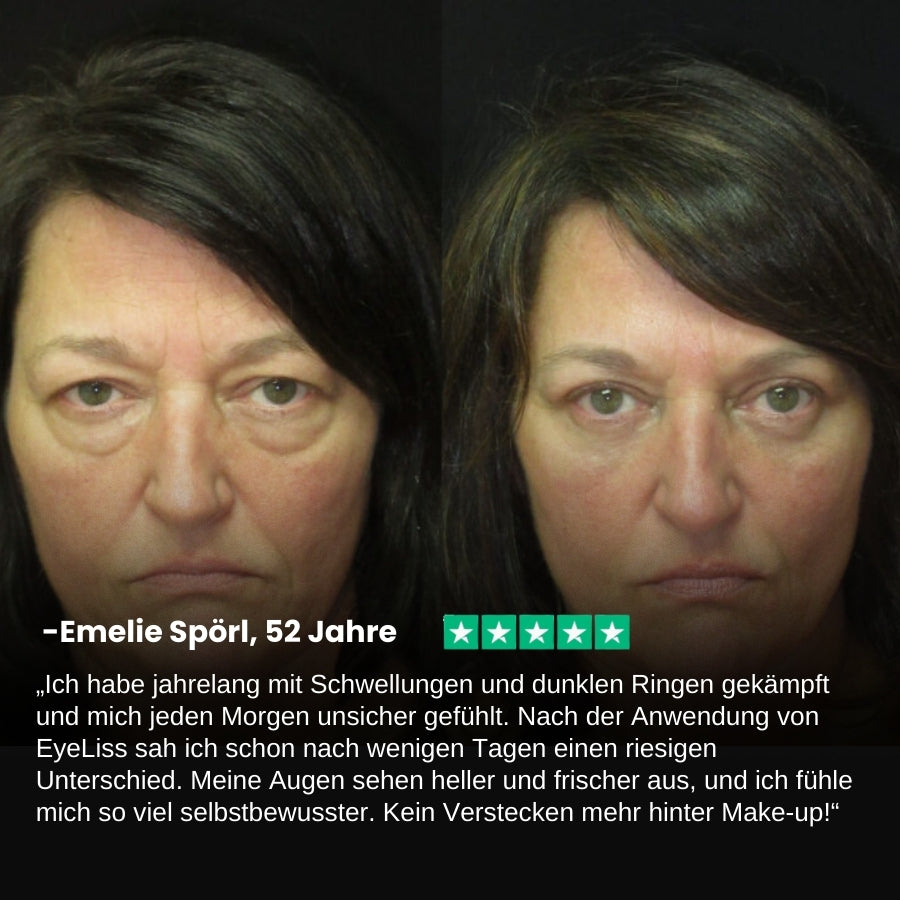 EyeLiss™ | Retinol Augen-Stick Creme