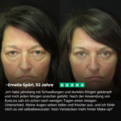 EyeLiss™ | Retinol Augen-Stick Creme
