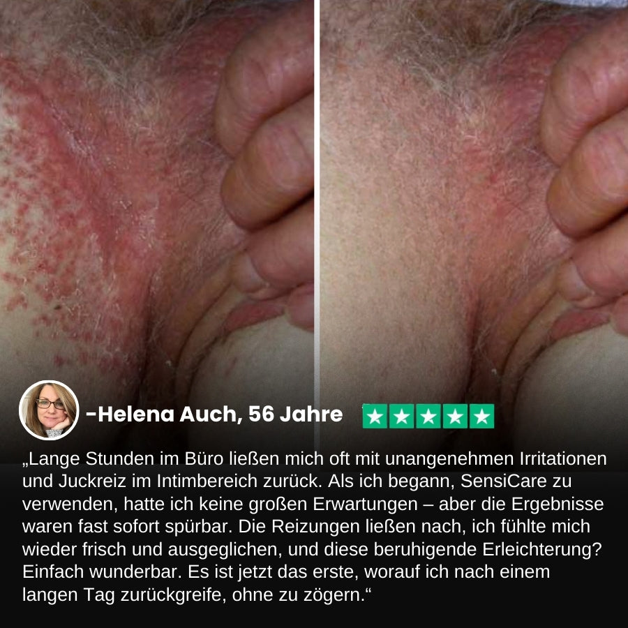 SensiCare™ | Frauen Intimjuckreiz Linderung Creme