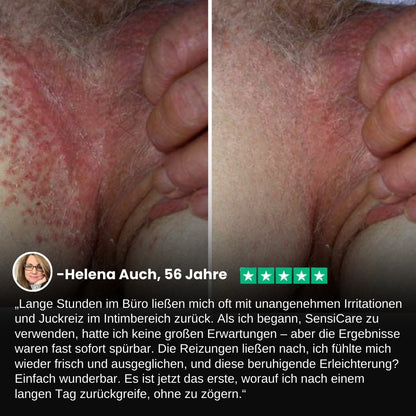 SensiCare™ | Frauen Intimjuckreiz Linderung Creme